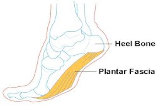 5 Exercises To Cure Heel Pain Due To Plantar Fasciitis | OnlyMyHealth